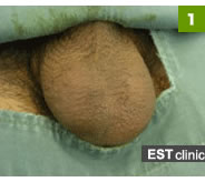 1. 手術前の状態。